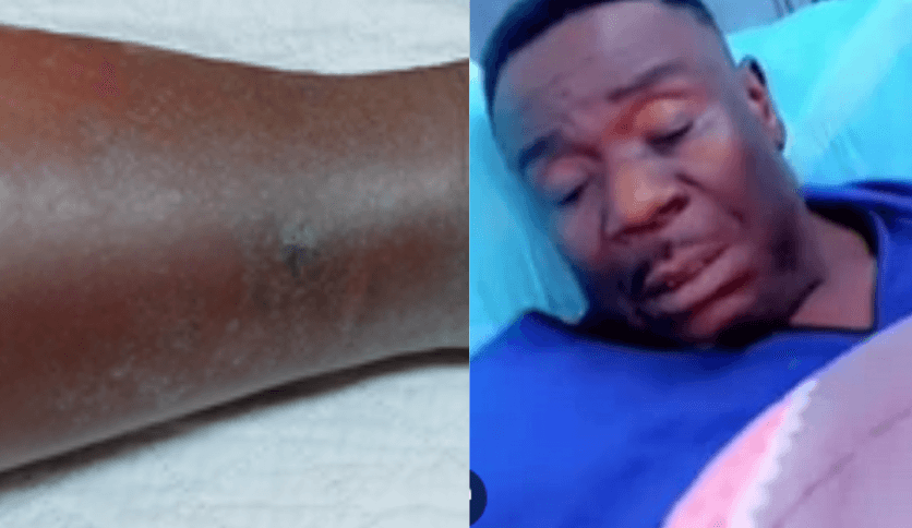 Nollywood Star Mr. Ibu Undergoes Leg Amputation in Ongoing Health Battle https://viraltrendx.ezzybrown.com.ng/