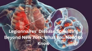 Legionnaires’ Disease Spreading Beyond New York: What You Need to Know